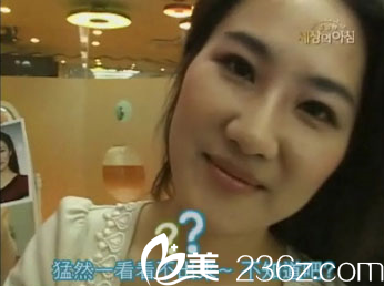 美來可整形醫(yī)院面部提升術(shù)前 美來可整形醫(yī)院面部提升術(shù)前