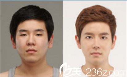 德萊茵整形外科真人案例術(shù)前術(shù)后對(duì)比