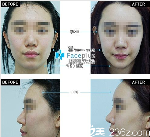 FacePlus整形外科醫(yī)院案例