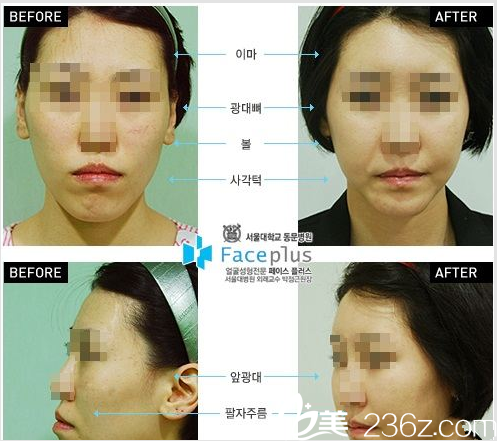 FacePlus整形外科醫(yī)院案例