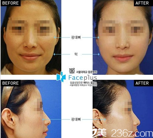 FacePlus整形外科醫(yī)院案例