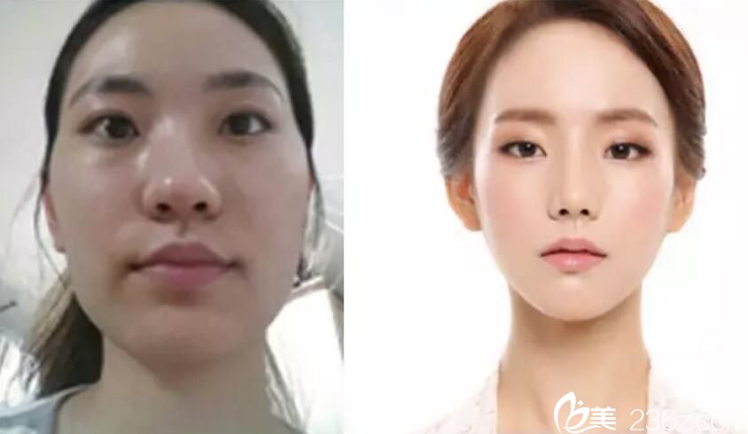 沈炯坤院長(zhǎng)打造的案例 沈炯坤院長(zhǎng)打造的案例