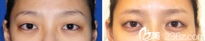 A特整形醫(yī)院案例