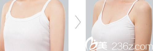 A特整形醫(yī)院案例