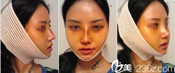 A特整形中心案例 A特整形中心案例