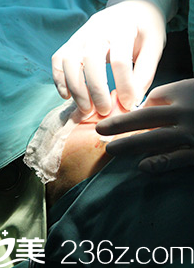 <!--<i data=20240703-sp></i>-->醫(yī)生手術(shù) <!--<i data=20240703-sp></i>-->醫(yī)生手術(shù)