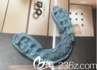 美爾韓醫(yī)院顏面矯正量身定制矯正器 美爾韓醫(yī)院顏面矯正量身定制矯正器