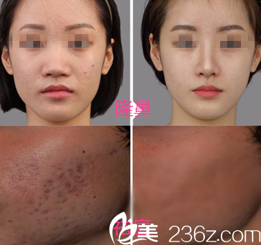  重慶美侖美奐整形姬廣翰真人案例