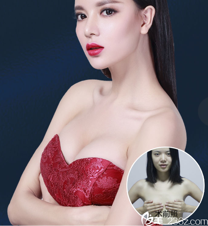 柳州華美隆鼻隆胸