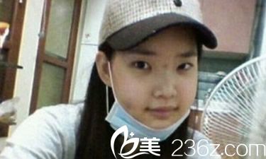 泉州王主任豐下巴第三天