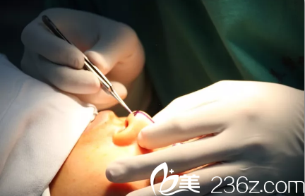 王文院長開始對鼻部進(jìn)行設(shè)計 王文院長開始對鼻部進(jìn)行設(shè)計