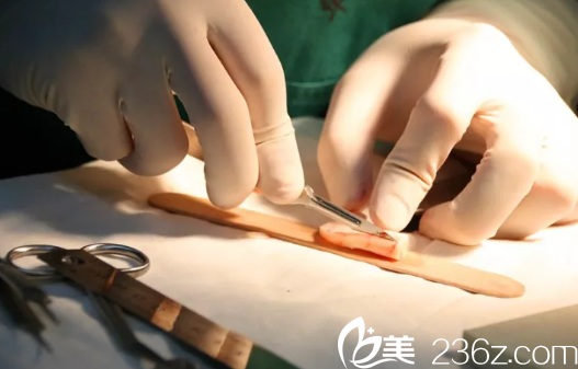 肋軟骨鼻尖雕刻 肋軟骨鼻尖雕刻