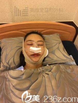 韓國美迪瑩整形真人案例2 韓國美迪瑩整形真人案例2