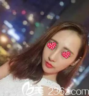 術(shù)后第7天隆鼻修復(fù)恢復(fù)情況