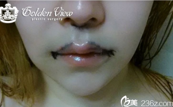 宋尚勛院長做的嘴角上揚(yáng)