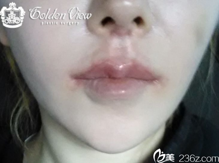 goldenview整形醫(yī)院