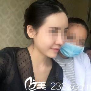 崔鐘武院長膨體隆鼻7天后 崔鐘武院長膨體隆鼻7天后