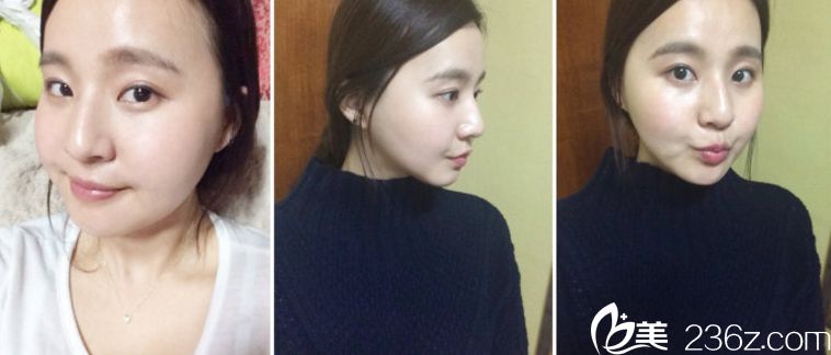 鄭宰永 院長(zhǎng)宰韓國(guó)出名嗎 鄭宰永 院長(zhǎng)宰韓國(guó)出名嗎