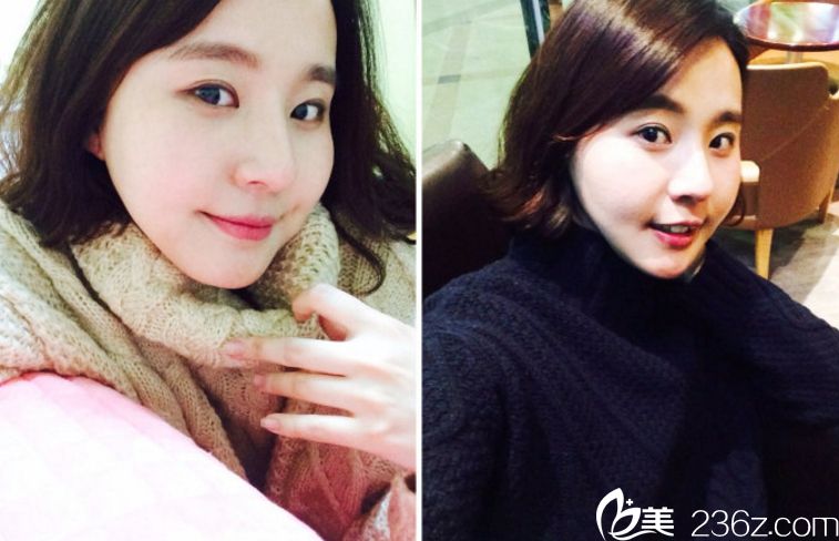 LAVIAN整形外科醫(yī)院vline手術(shù) LAVIAN整形外科醫(yī)院vline手術(shù)