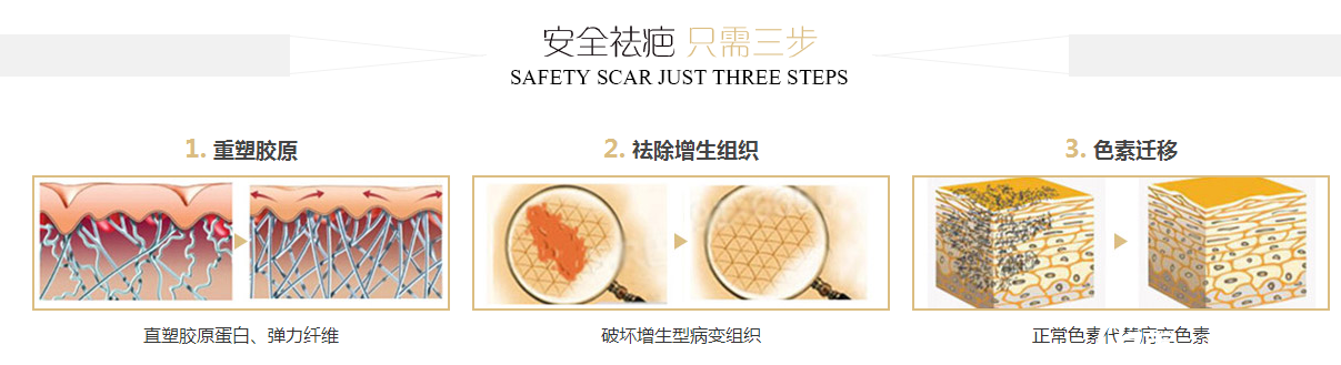 黃志勇醫(yī)生祛疤原理 黃志勇醫(yī)生祛疤原理