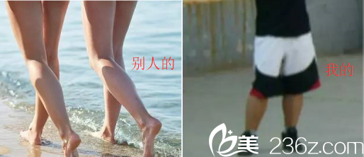 小腿粗是種什么樣的體驗