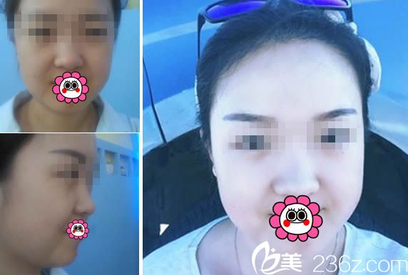 呼市華美效果案例 呼市華美效果案例