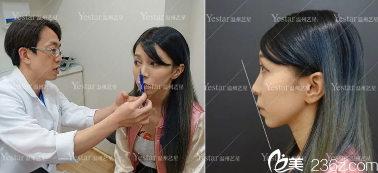 手術方案設計過程 手術方案設計過程