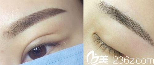 駐馬店締萊美紋眉案例