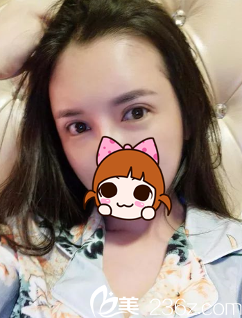 術(shù)后第七天