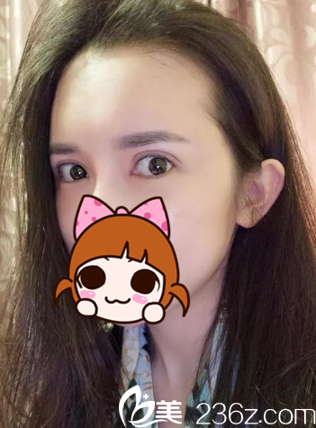 丁梅絲主任說讓我不要吃辛辣食物