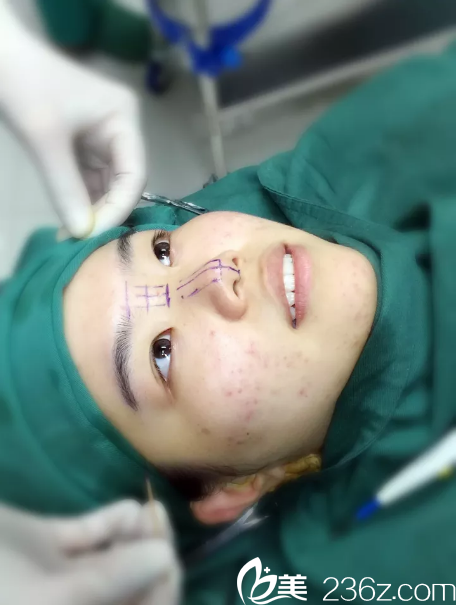 寧波和波珀悅設(shè)計的鼻手術(shù)方案 寧波和波珀悅設(shè)計的鼻手術(shù)方案