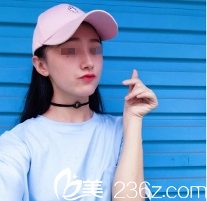 假體隆鼻7天見效！求重慶賽格爾馬強(qiáng)挺翹我的塌鼻梁+大鼻頭