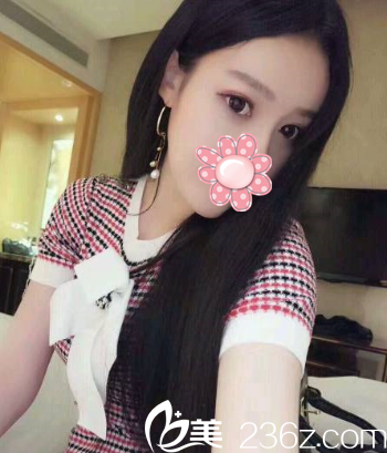 第32天完美蛻變