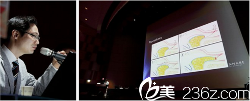 張院長發(fā)表眼底脂肪再排至演講 張院長發(fā)表眼底脂肪再排至演講