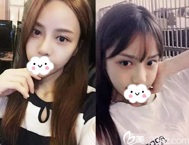 看人氣主播月入10W+只因在常熟瑞麗美貝爾做了雙眼皮和隆鼻