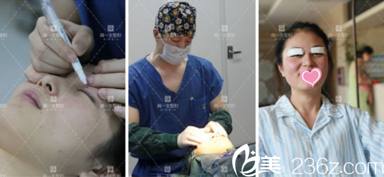 手術(shù)過程其實不疼 手術(shù)過程其實不疼