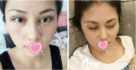 雖然沒有恢復(fù)還是可以的 雖然沒有恢復(fù)還是可以的