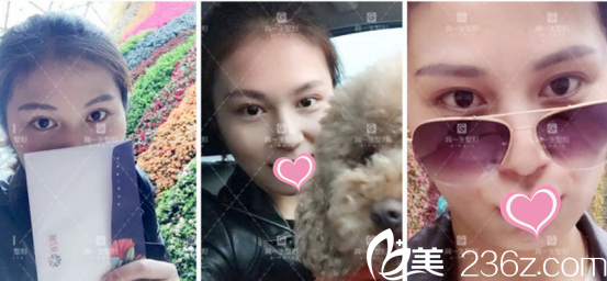 恢復(fù)的挺快的 恢復(fù)的挺快的