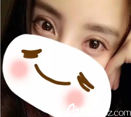 微創(chuàng)雙眼皮7天消腫 微創(chuàng)雙眼皮7天消腫