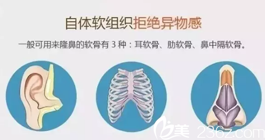 季澤東院長做定制美鼻術(shù) 季澤東院長做定制美鼻術(shù)