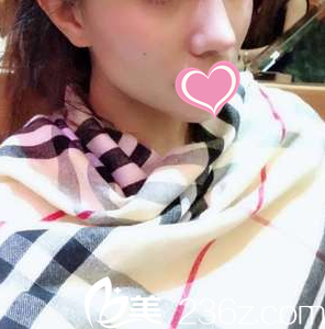 術(shù)后十五天效果