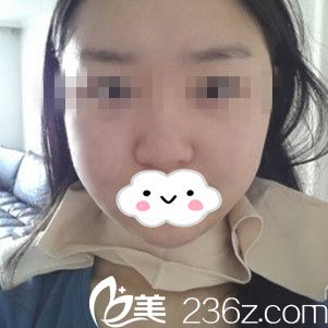 手術(shù)前的我 手術(shù)前的我