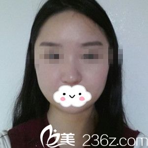 手術(shù)后七天 手術(shù)后七天