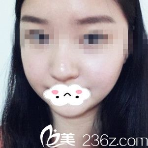 手術(shù)第十天 手術(shù)第十天