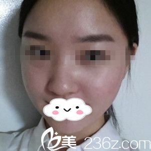 手術(shù)后一個月 手術(shù)后一個月