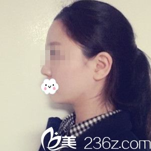 術(shù)后50多天 術(shù)后50多天