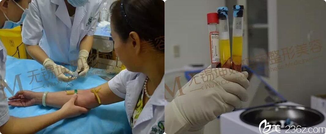 抽取血液通過離心機得到PRP備用 抽取血液通過離心機得到PRP備用