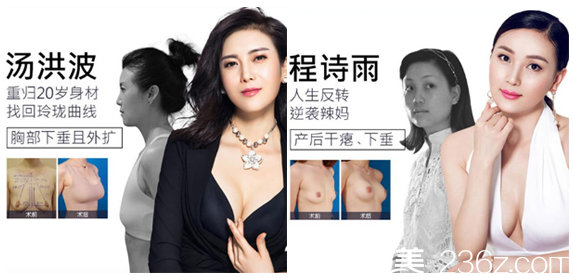 深圳美萊郭杰做的假體隆胸<span style= 深圳美萊郭杰做的假體隆胸<span style=