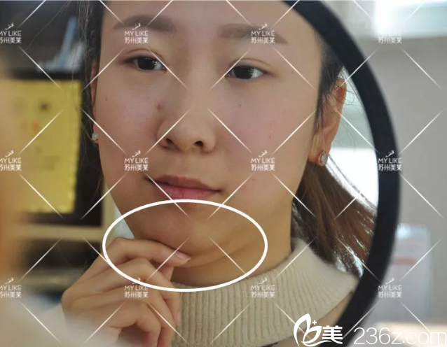 難以掩蓋的雙下巴肉肉形象