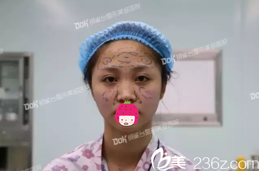 臉上爬滿(mǎn)烏龜?shù)内s腳